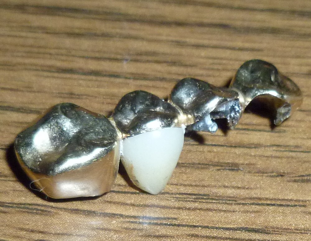 0810 teeth 003.jpg