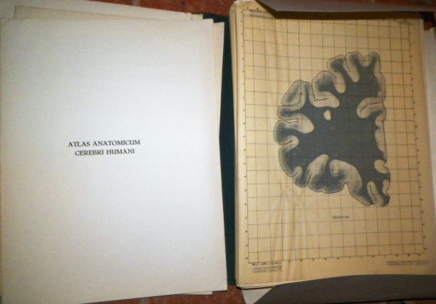 book brain book 4aa.JPG